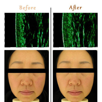 led face mask light therapy led mask red light IR photon skin rejuvenation - view 8